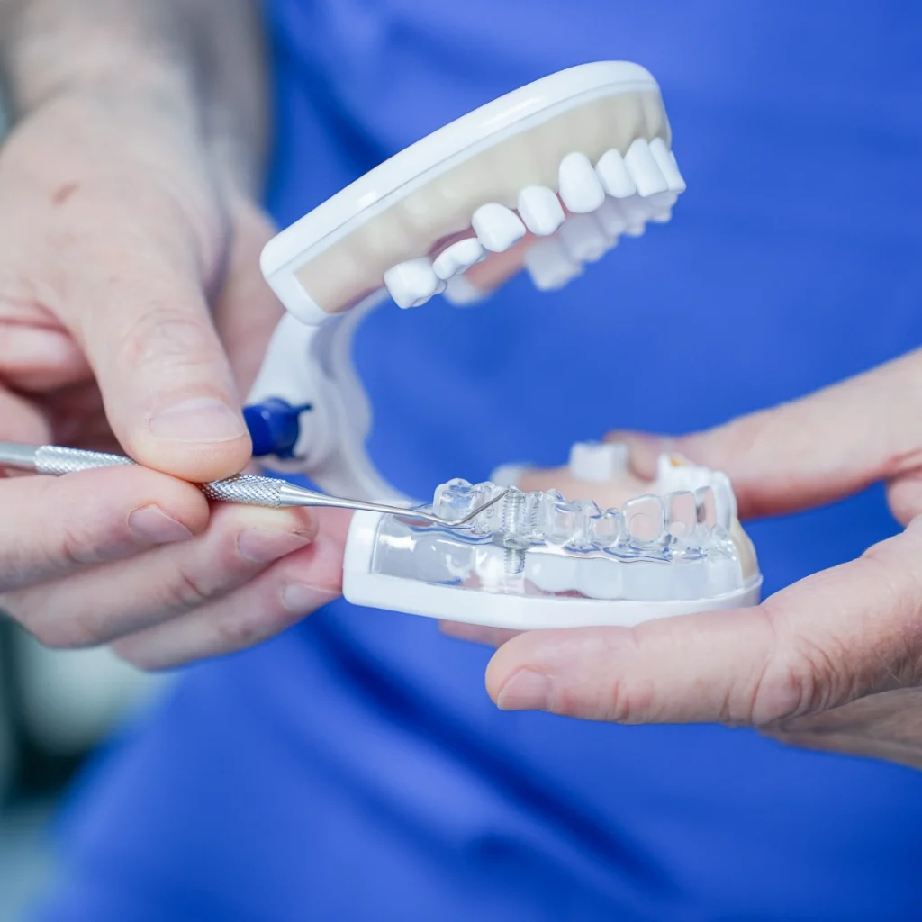 impianto dentale a schio impianto dentale a schio