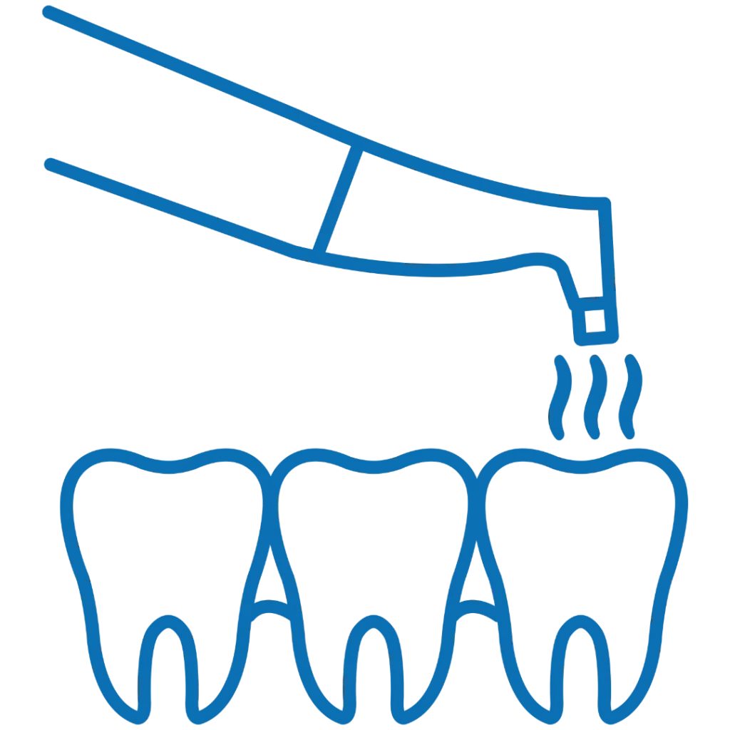 Parodontologia 20 Studio Dentistico a Schio Dr. Pellegrini