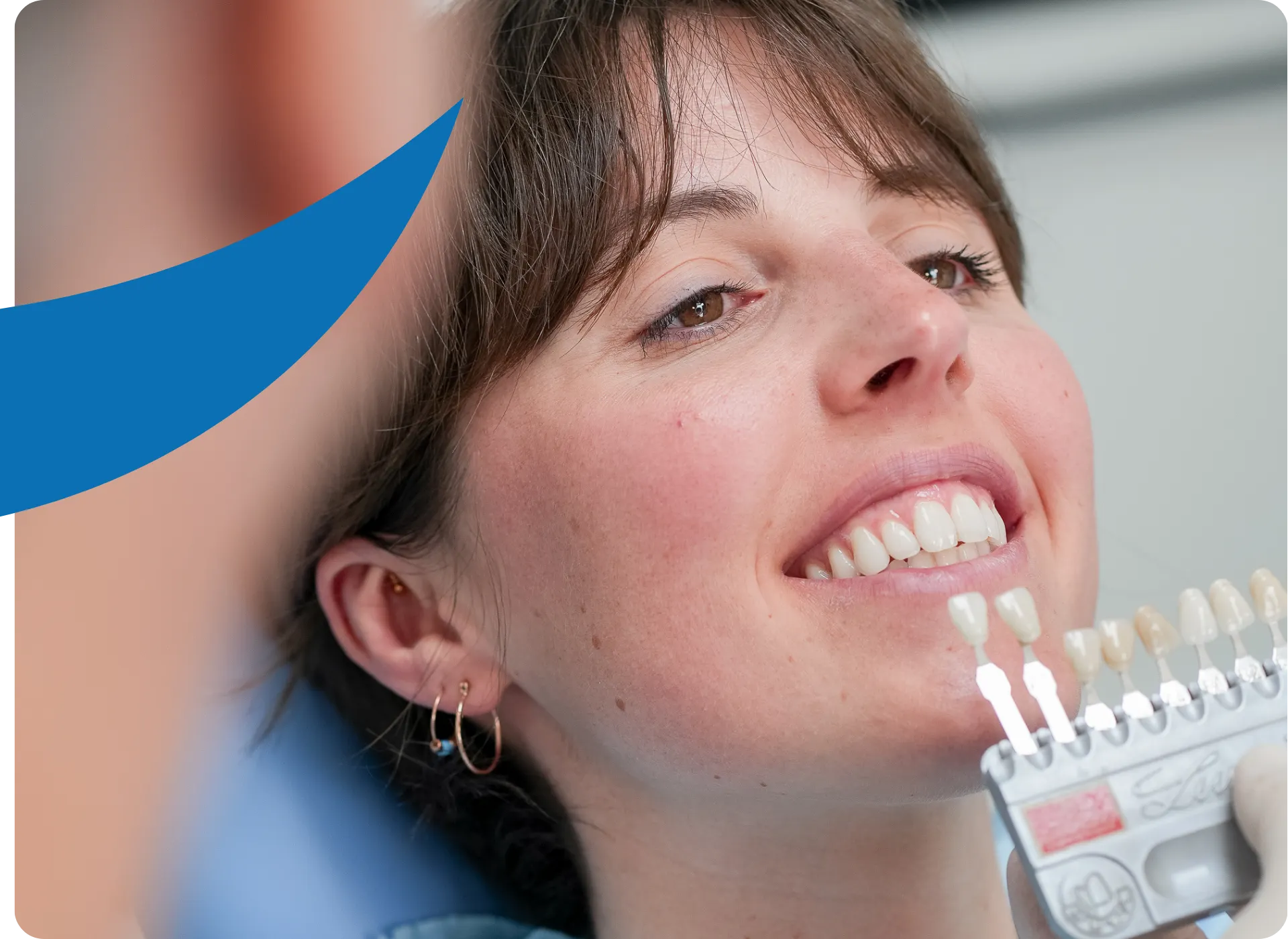Home 4 CORE 3 Faccette Dentali a Schio 1