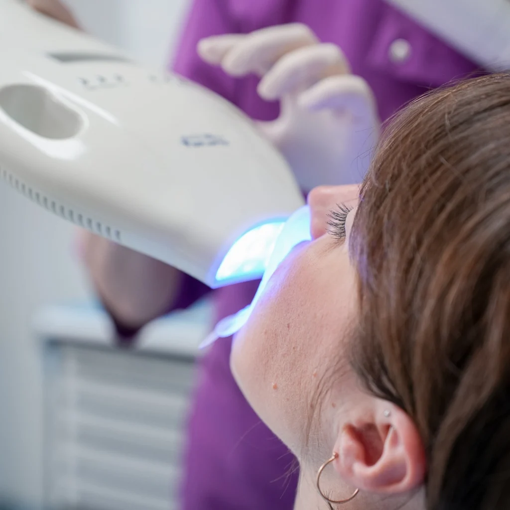sbiancamento dentale a schio sbiancamento dentale a schio