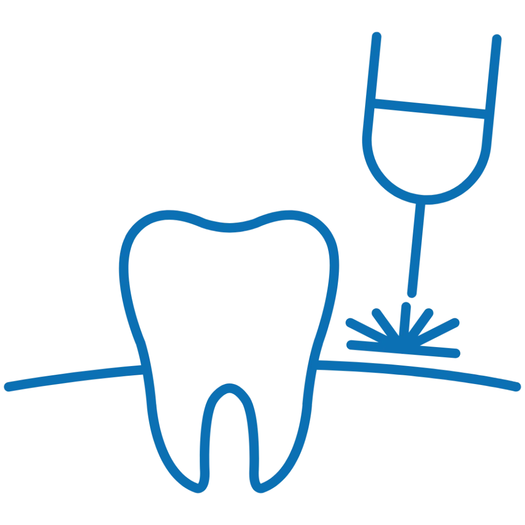 Parodontologia 19 Studio Dentistico a Schio Dr. Pellegrini